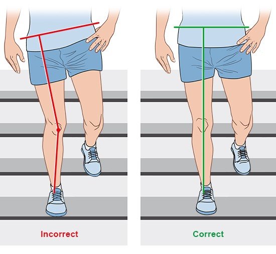 Illustration: Alignment of the leg while going down stairs