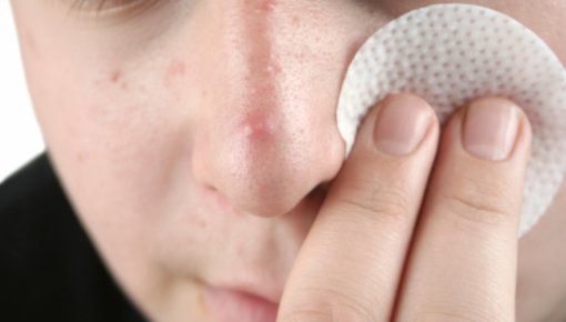 Photo of young man cleansing his skin