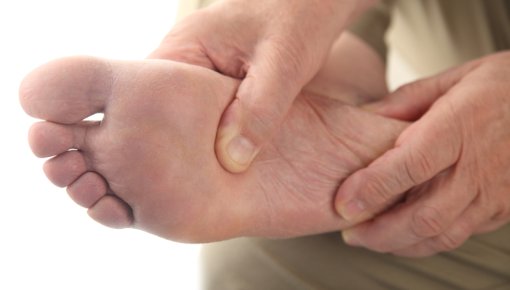 Photo of the sole of a foot