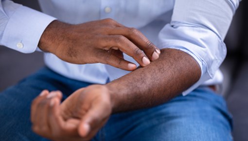 Photo of a man’s forearm