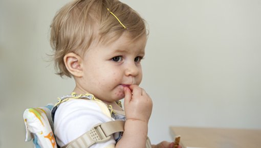 Photo of a toddler with a rash around their mouth