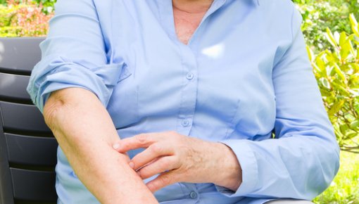 Photo of a woman looking at the skin on her arm