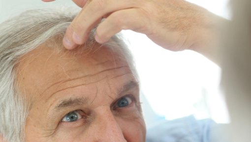 Photo of a man looking at his forehead in the mirror