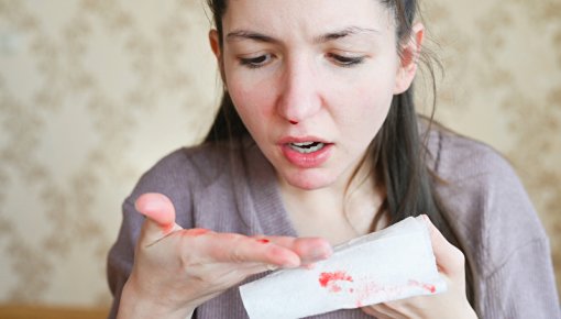 Photo of young woman with nosebleed and handkerchief