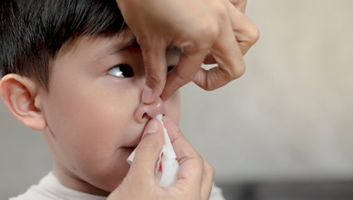 Photo of a young boy with a nosebleed