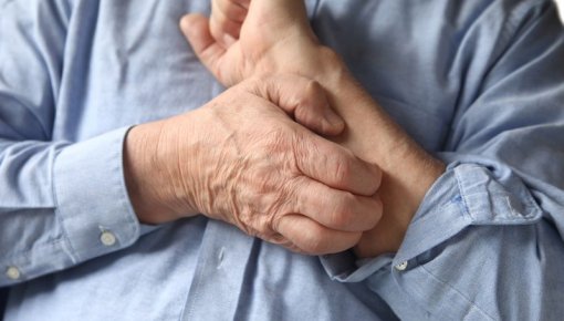 Photo of a man who has eczema