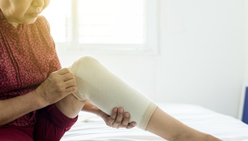 Photo of a woman with compression stockings 