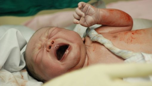 Photo of a newborn baby