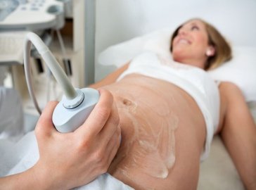 Photo of a pregnant woman having an ultrasound scan