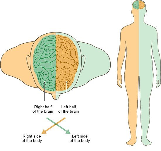 This illustration shows the two hemispheres of the brain: the right half controls the left side of the body, and the left half controls the right side.