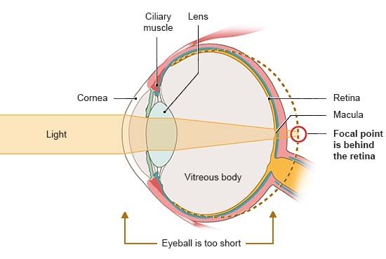 Illustration: Anatomical diagram of an eye in side view