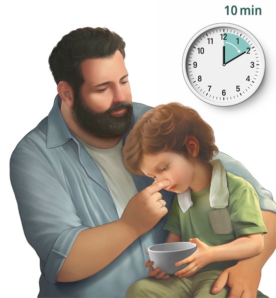 Illustration: Stopping nosebleeds in children