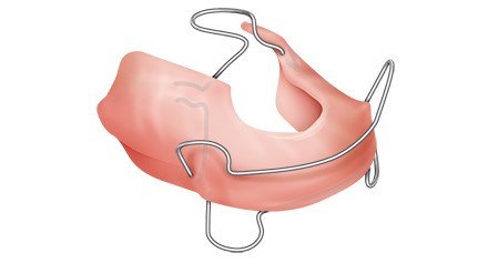 Illustration: The Bionator is made up of one piece