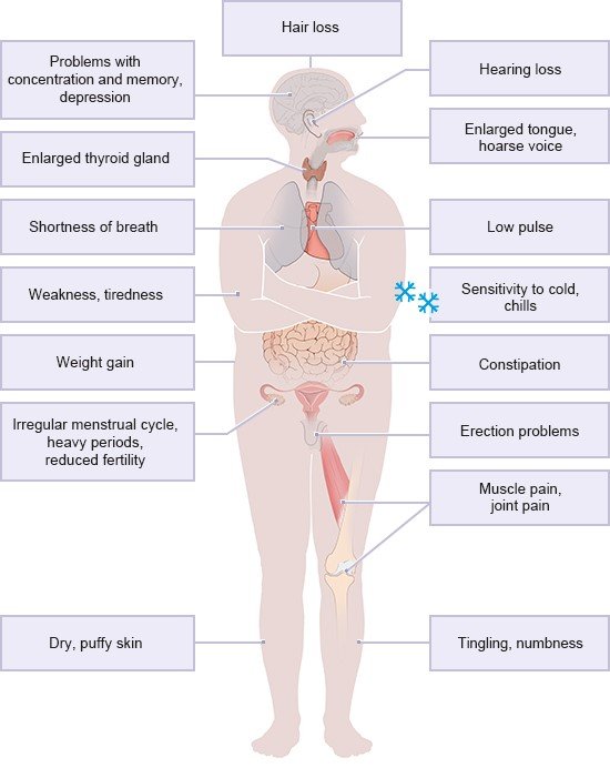 Illustration: Possible symptoms of Hashimoto’s disease