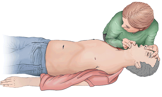 This animated illustration shows how to give mouth-to-mouth resuscitation to someone lying on the ground.