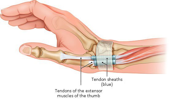This anatomical illustration shows a lateral view of how the tendons of the extensor pollicis longus muscle are protected by sheaths of connective tissue known as tendon sheaths.
