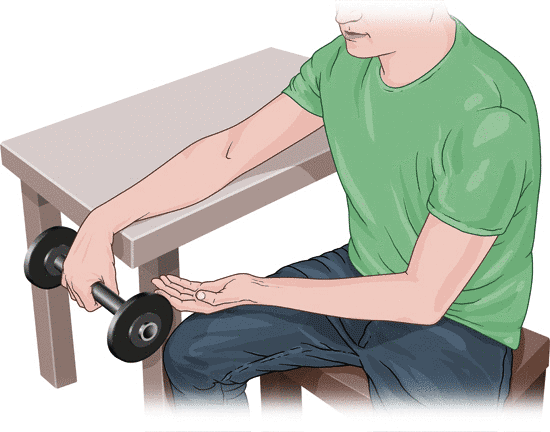 The animated illustration shows an eccentric exercise for tennis elbow in which the arm is slowly lowered with a dumbbell.