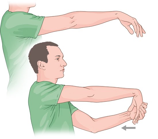 The illustration shows a stretching exercise that can be used for tennis elbow. It stretches the wrist extensor muscles in the forearm.