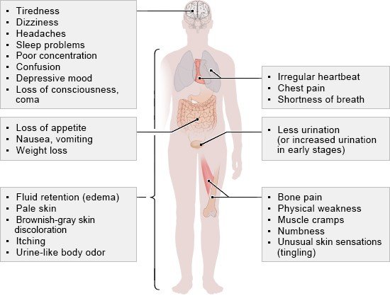 The illustration shows possible symptoms of chronic kidney disease