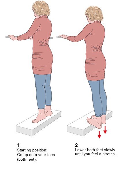 This two-part schematic illustration shows a woman doing an exercise to stretch and strengthen her foot and leg on a step. The left side shows the starting position. The right side shows how the feet are lowered to stretch them.