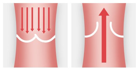Heart valves ensure that the blood flows in only one direction. The left illustration shows a closed heart valve; the right illustration shows an open one.