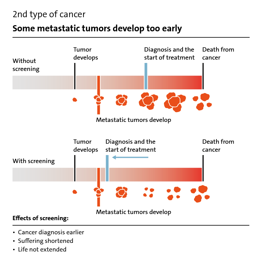 Illustration: Effect of screening for the 2nd type of cancer