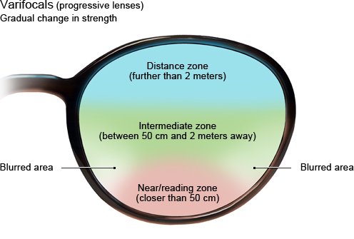 Illustration: Varifocals (progressive lenses) with gradual change in strength