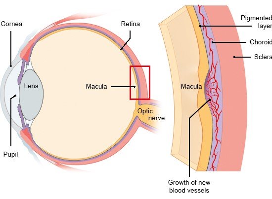 Illustration: Structure of the eye and growth of new blood vessels – as described in the article