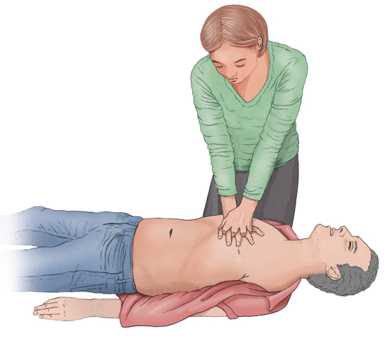 Illustration: Chest compressions – as described in the article