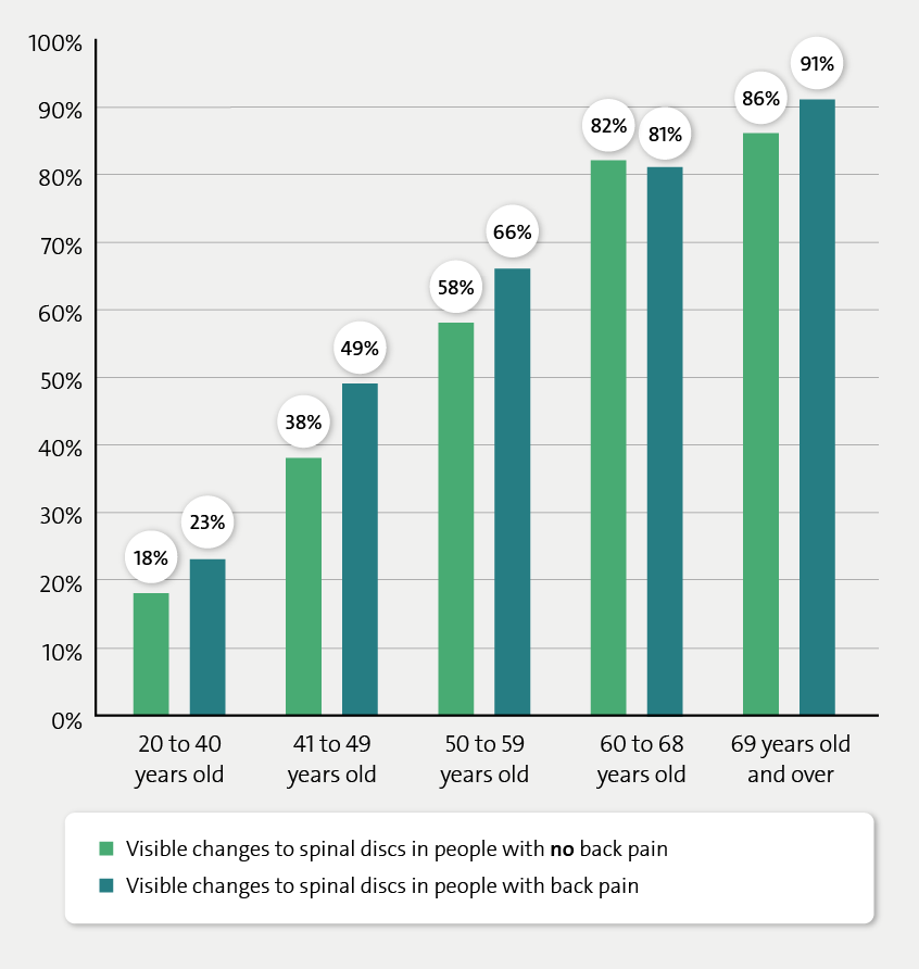 The bar chart shows changes to the spinal discs of people in different age groups (with and without back pain) as a percentage.