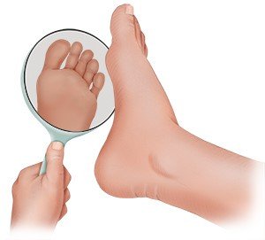 Illustration: Checking your feet with the help of a hand mirror