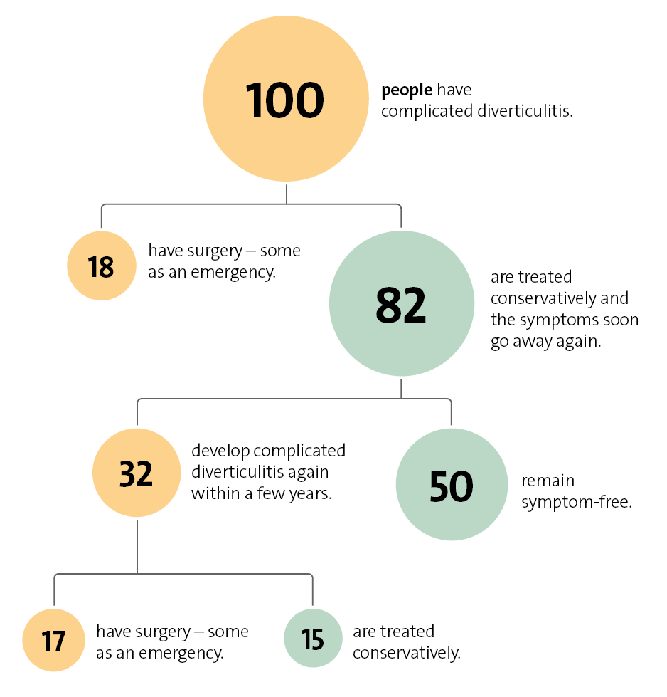 This simplified diagram shows the course of complicated diverticulitis in 100 people with the disease