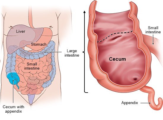 Illustration: The appendix hangs off the end of the cecum