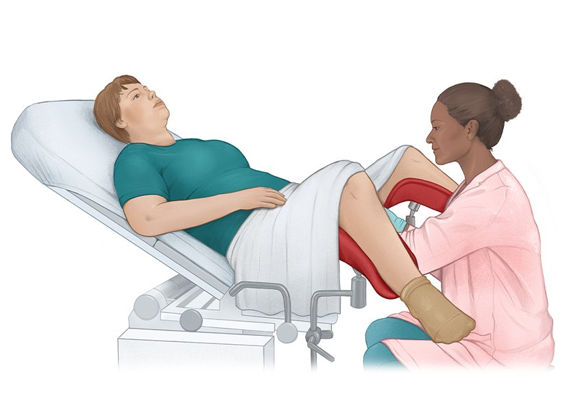 The illustration shows a patient (left) being examined on a gynecological chair.
