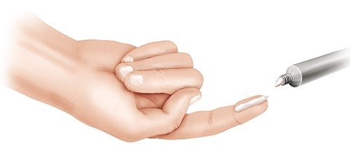 Illustration: 1 fingertip unit (1 FTU) – as described in the article