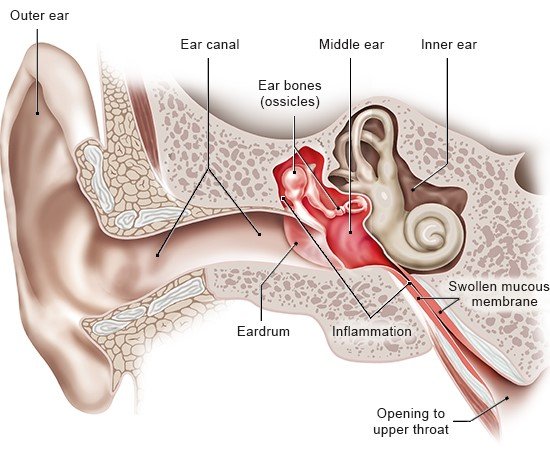 Illustration: Middle ear infection