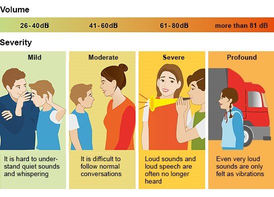 Illustration: Different degrees of hearing loss