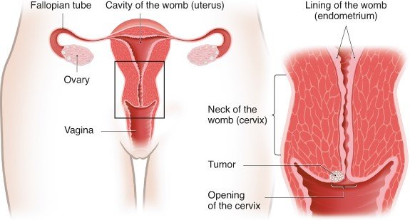 Illustration: Cervix and opening of the cervix