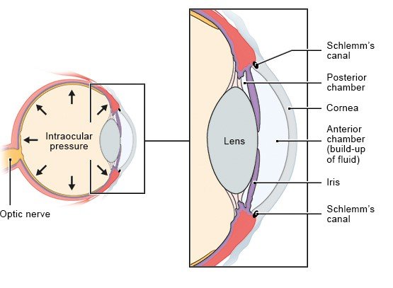 Illustration: Glaucoma