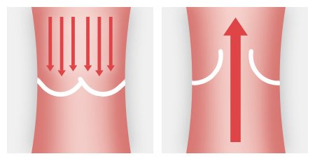 Illustration: The curved flaps ensure that the blood flows in only one direction