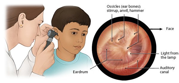 Illustration: Otoscopy and view of the eardrum – as described in the article