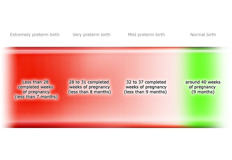 Illustration: Three categories of preterm birth – as described in the article