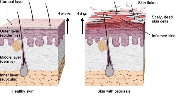 Illustration: Growth and shedding of skin cells – as described in the article