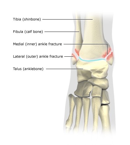 Illustration: Ankle injuries: Fracture of inner and outer ankle – as described in the article