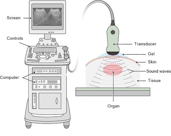 Illustration: Ultrasound machine with a screen and transducer – as described in the article