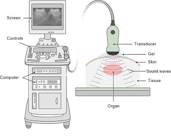 Illustration: Ultrasound machine with a screen and transducer – as described in the information