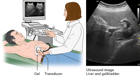 Illustration: An abdominal ultrasound can be used to examine the liver, for example