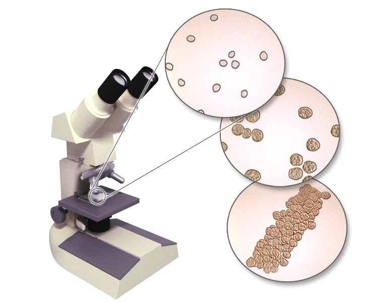 Illustration: Microscopic examination of the solid parts