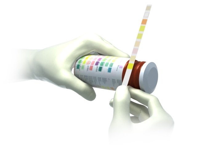 Illustration: Rapid urine test