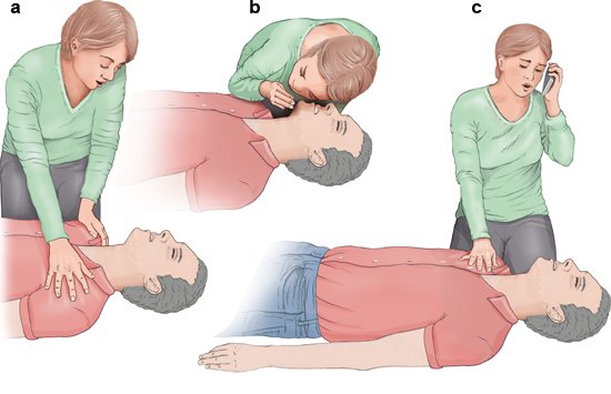 Illustration: CPR – The first steps: a) Check consciousness, b) Check breathing, c) Dial 112 (or 911 in the U.S.)